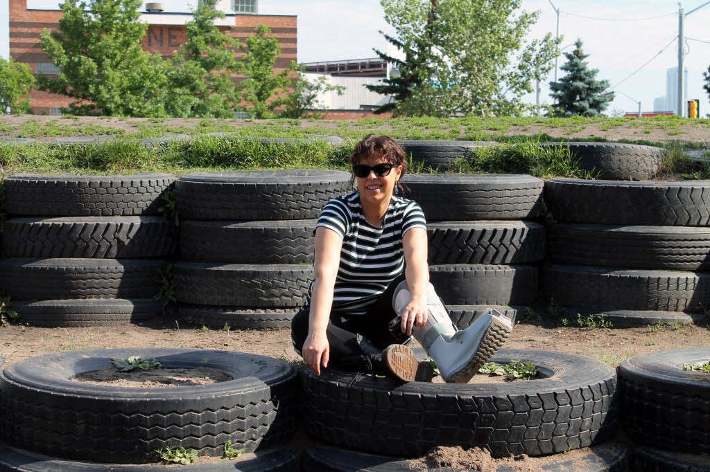 kateryna with a broken leg